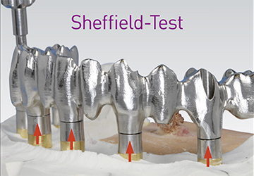 Sheffield-Test 4